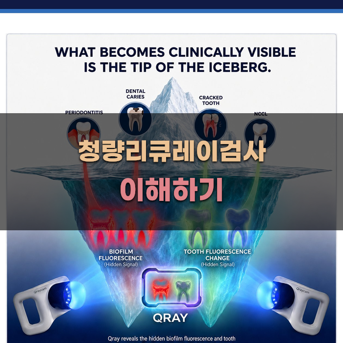 청량리큐레이검사 이해하기
