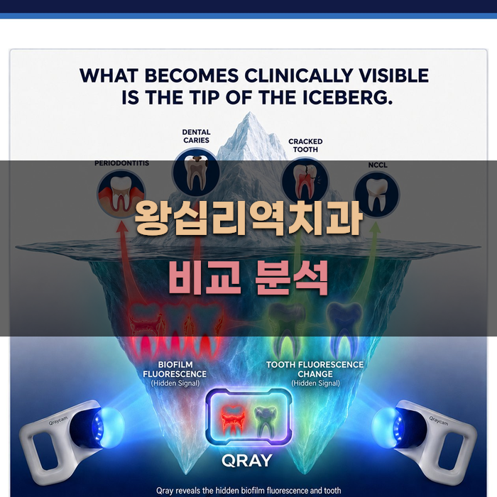 왕십리역치과 비교 분석하여 최선 선택하기