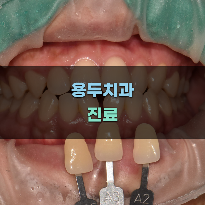용두치과 진료 과정에 대한 이해