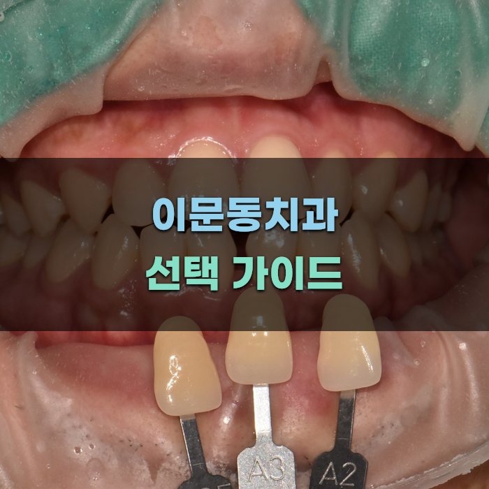 이문동치과 선택 가이드