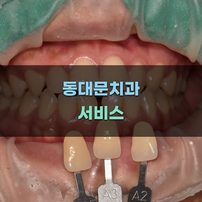 동대문치과의 서비스 및 가격 비교
