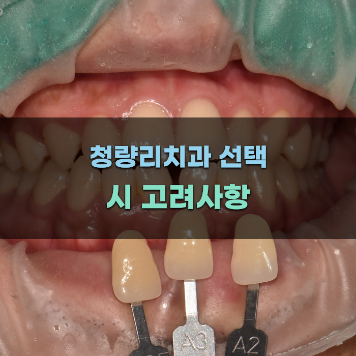 청량리치과 선택 시 고려해야 할 점