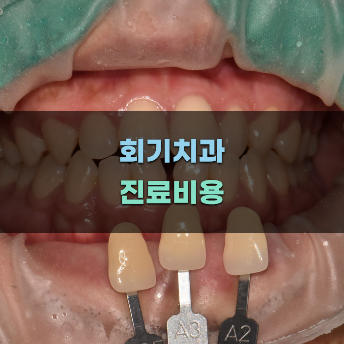 회기치과 진료비용 비교 분석