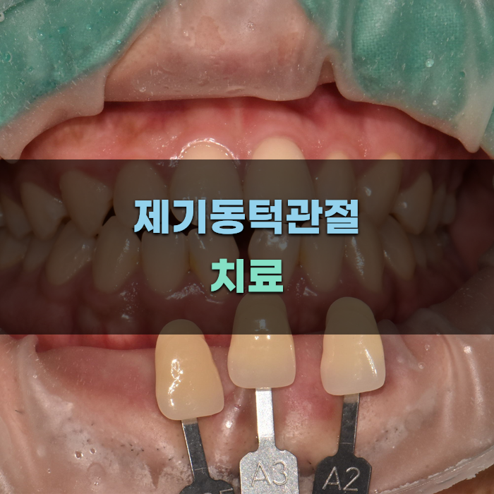 제기동턱관절 치료 방법과 효과