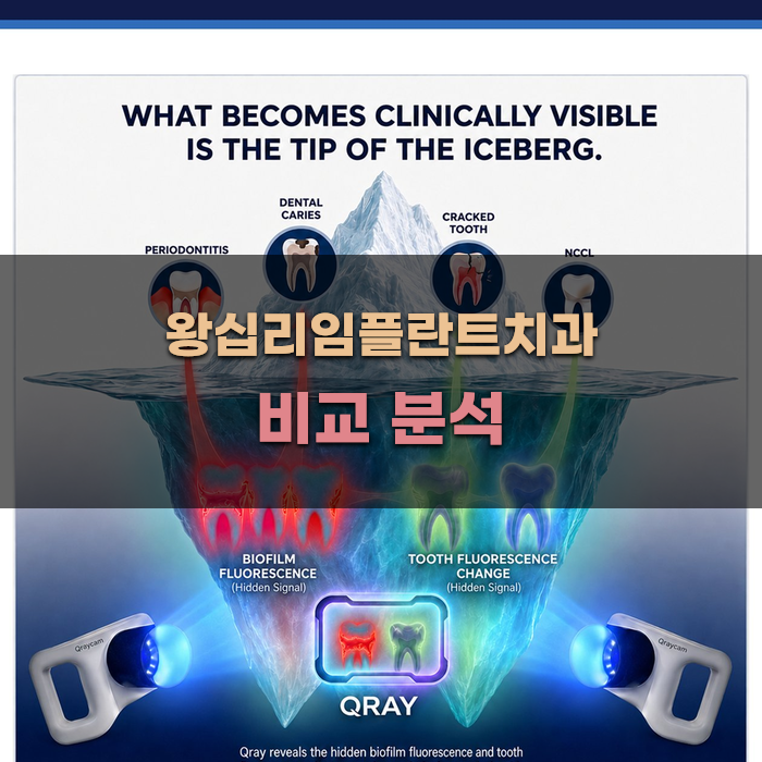 왕십리임플란트치과 비교 분석