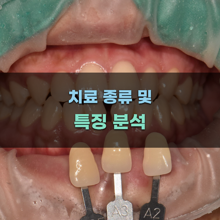 용두동치과 치료 종류 및 특징 분석