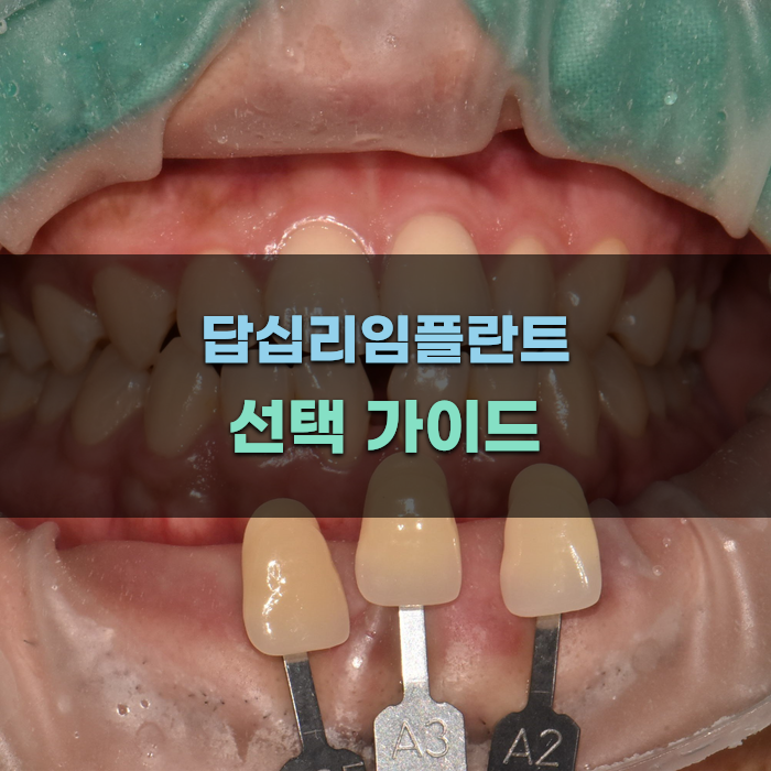 답십리임플란트 선택 가이드