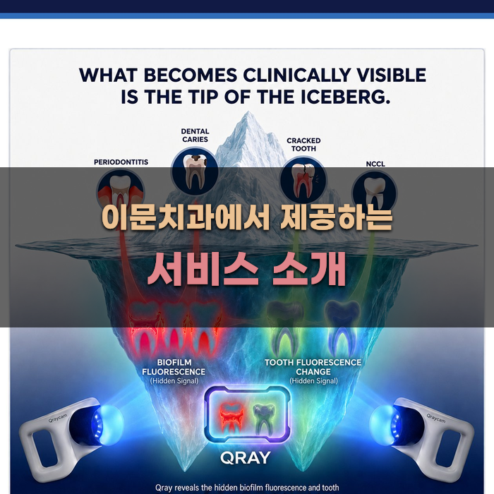 이문치과에서 제공하는 서비스 소개