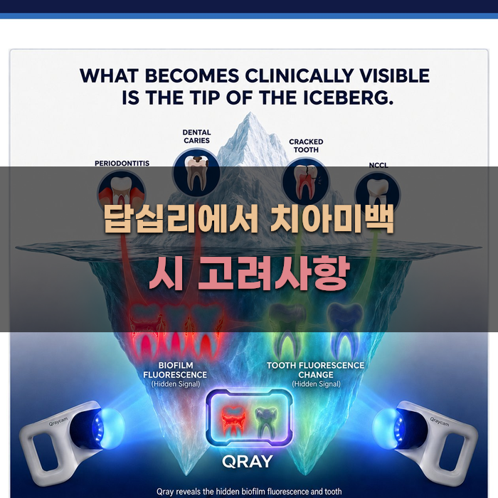 답십리에서 치아미백 시 고려사항