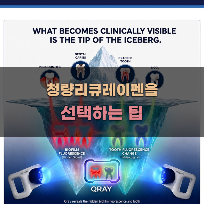 청량리큐레이펜을 선택하는 팁