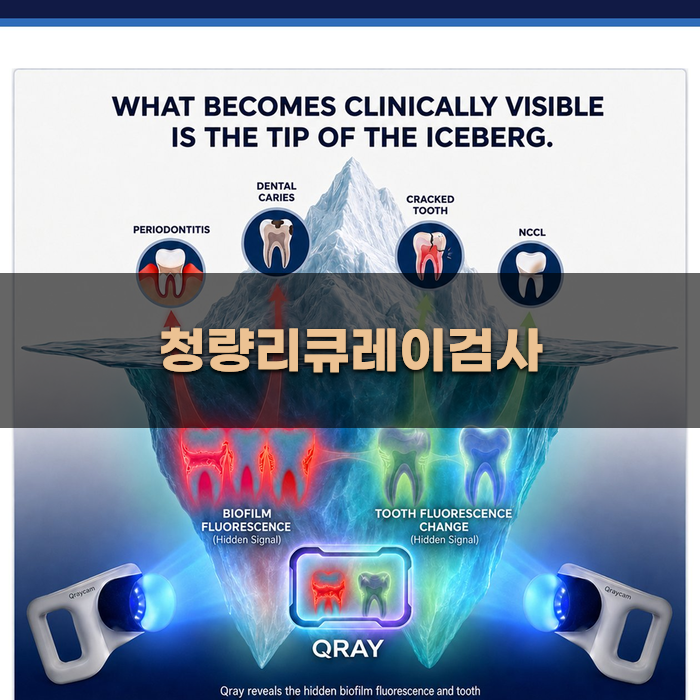 청량리큐레이검사 필요성 분석