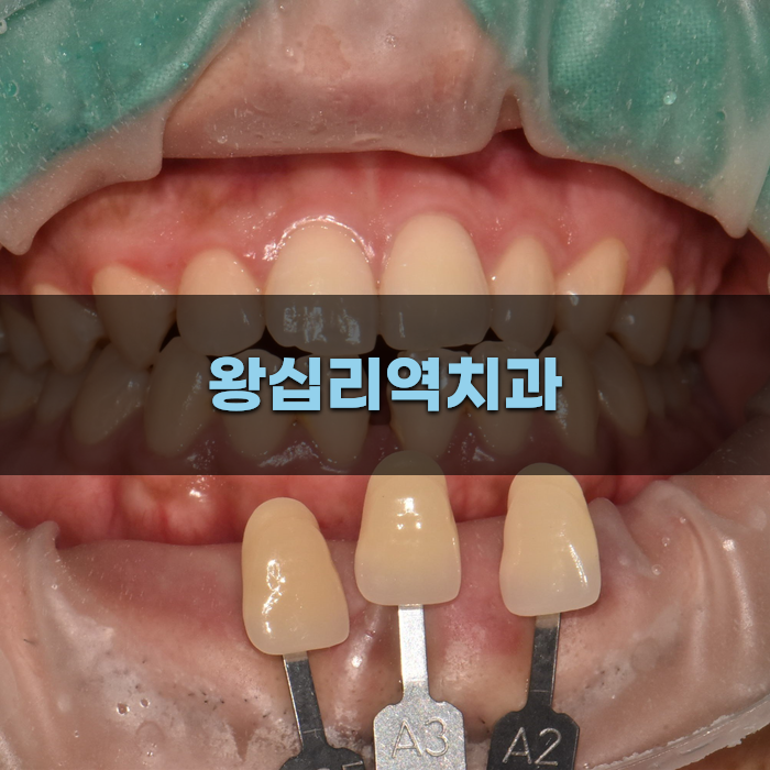 왕십리역치과에서 시행하는 최신 치료법